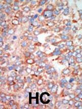 Anti-MST3 (C-term) Antibody