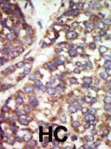 Anti-PAK2 (N-term) Antibody