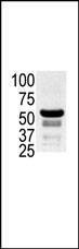 Anti-PAK2 (N-term) Antibody
