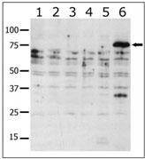 Anti-PAK6 Antibody