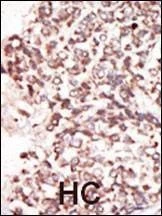 Anti-PIM2 (C-term) Antibody