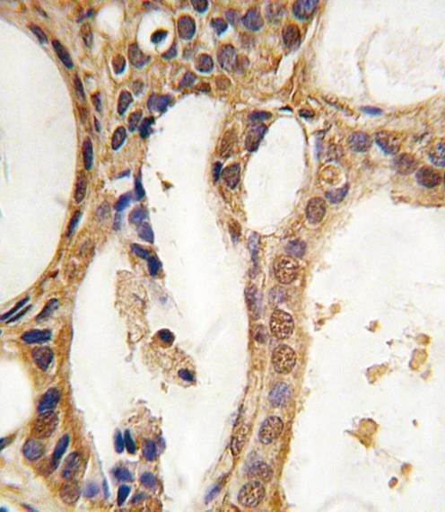 Anti-PIM1 Antibody
