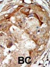 Anti-SGK3 (Center) Antibody