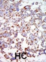 Anti-TAK1 (C-term) Antibody