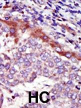 Anti-HUNK (C-term) Antibody