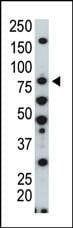 Anti-HUNK (C-term) Antibody