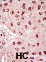 Anti-MEK1 (MAP2K1) (N-term) Antibody