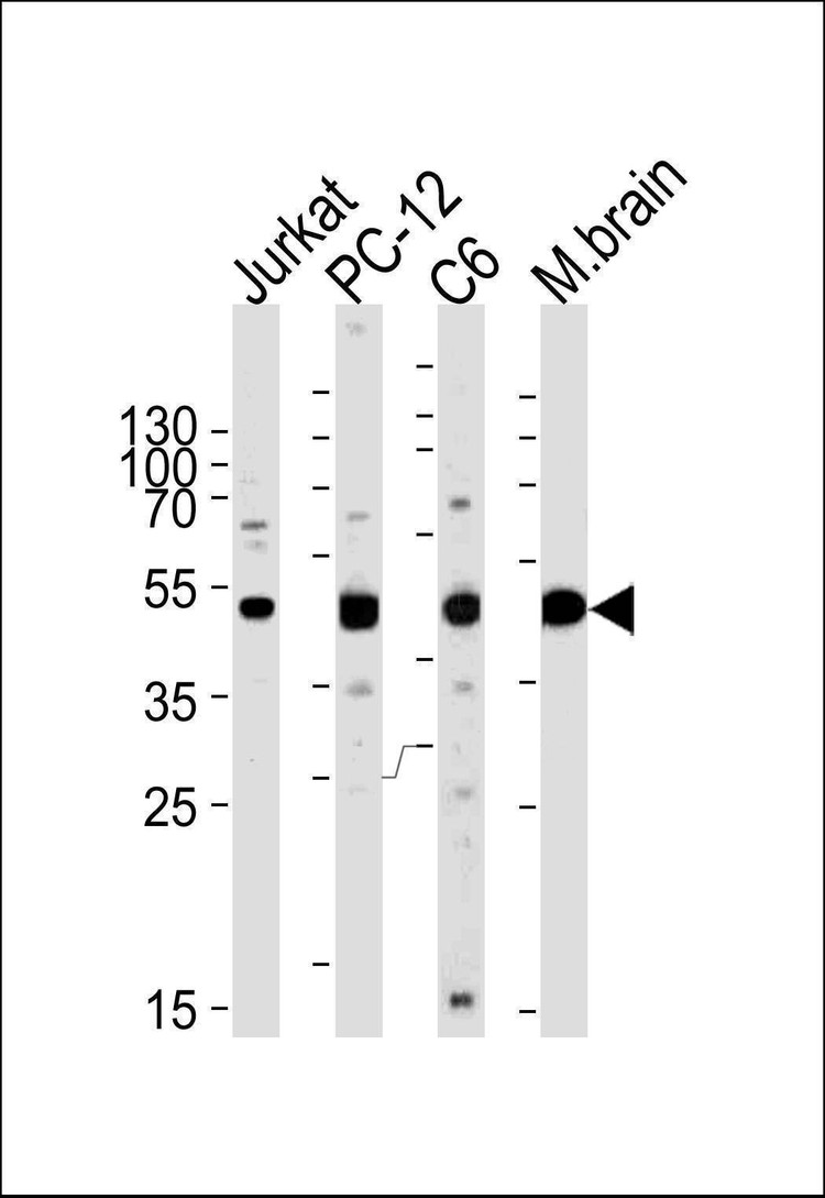 Anti-MEK1 (MAP2K1) (N-term) Antibody