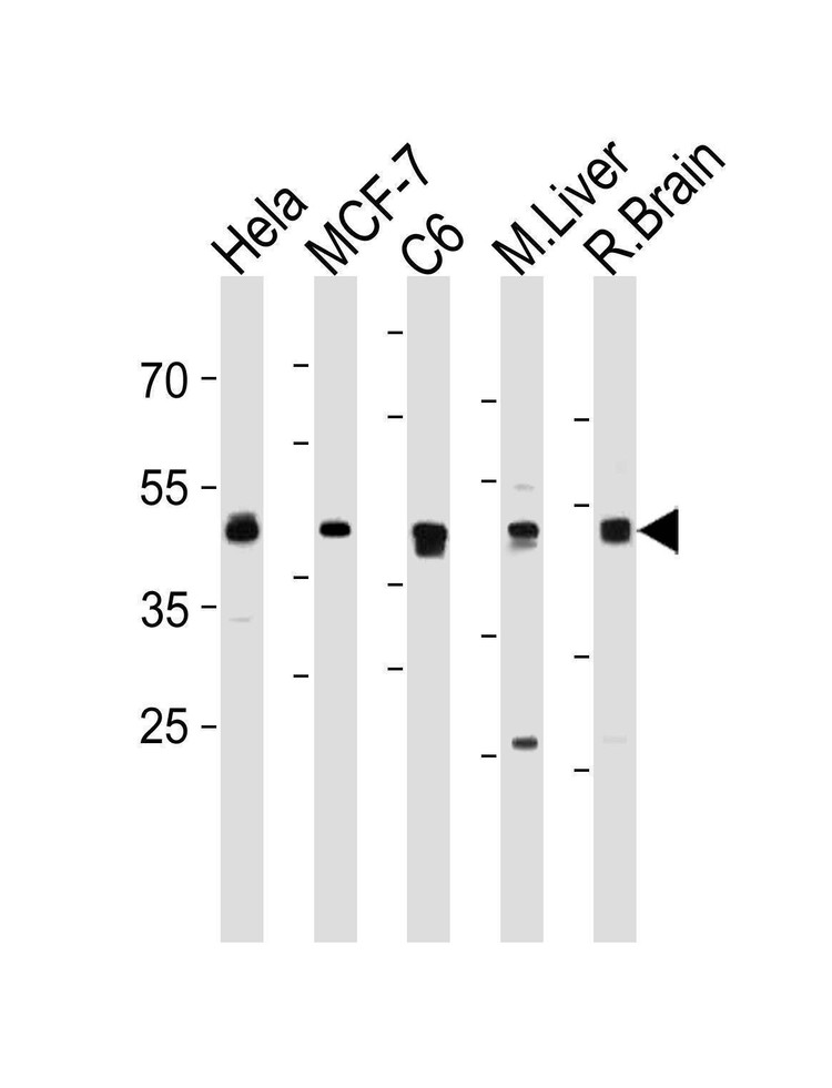 Anti-MEK2 (MAP2K2) (N-term) Antibody