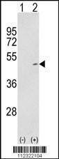 Anti-MAP2K2 (S222) Antibody