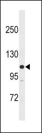 Anti-MLCK (N-term) Antibody