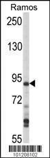 Anti-MAP4K1 (HPK1) (C-term) Antibody