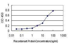 Anti-KCNMB4 Antibody