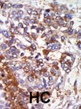 Anti-cGKI (cGKI beta) (C-term) Antibody
