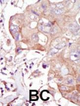 Anti-GLK (C-term) Antibody