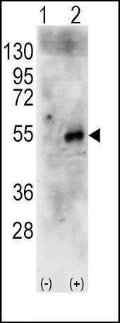 Anti-RPS6KB2 (Center) Antibody