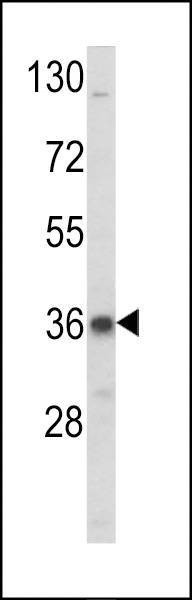 Anti-ARH (LDLRAP1) (N-term) Antibody
