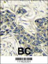 Anti-PI3KCA (Center) Antibody