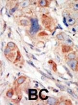 Anti-PI3KCD (C-term) Antibody