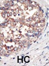 Anti-PI3KCG (C-term) Antibody