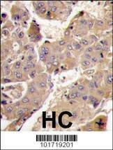 Anti-PIK3R3 (C-term) Antibody