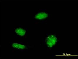 Anti-KHSRP Antibody
