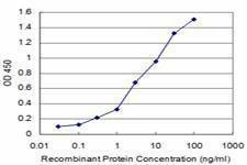 Anti-KHSRP Antibody