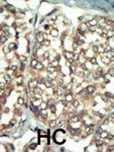 Anti-PI 4 Kinase type 2 beta (C-term) Antibody