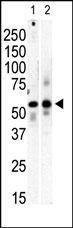Anti-PI 4 Kinase type 2 beta (C-term) Antibody