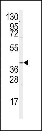 Anti-GNA12 (S67) Antibody