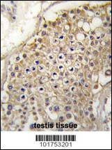 Anti-PIP5K2G (C-term) Antibody