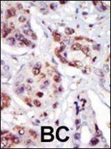 Anti-PIP5K2G (C-term) Antibody