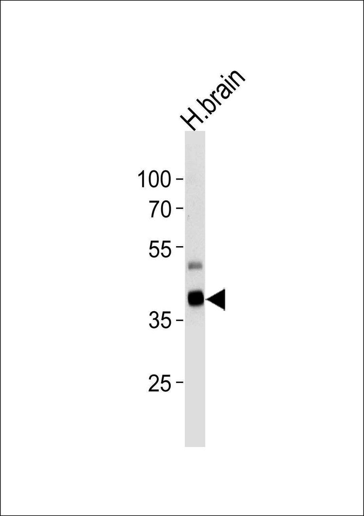 Anti-PIP5K2G (C-term) Antibody