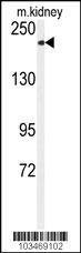 Anti-TRPM7 (CHAK1) (C-term) Antibody
