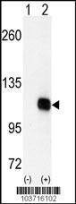 Anti-DGKZ (C-term) Antibody