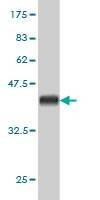 Anti-KIAA2002 Antibody