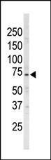 Anti-ARK5 (N-term) Antibody