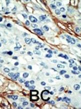 Anti-ARK5 (C-term) Antibody