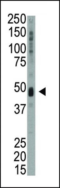 Anti-KIST (KIS) (N-term) Antibody
