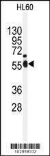 Anti-NEK2 (Center) Antibody