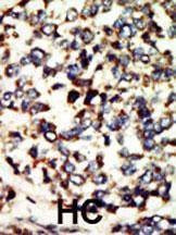 Anti-NEK7 (N-term) Antibody