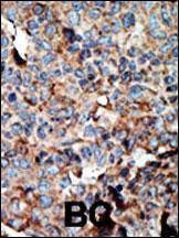 Anti-NME2 (N-term) Antibody