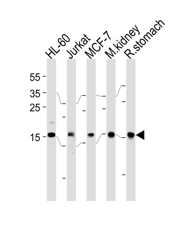 Anti-NME2 (N-term) Antibody
