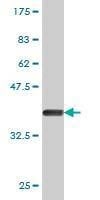 Anti-KIF1C Antibody