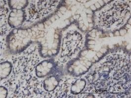 Anti-KIF1C Antibody