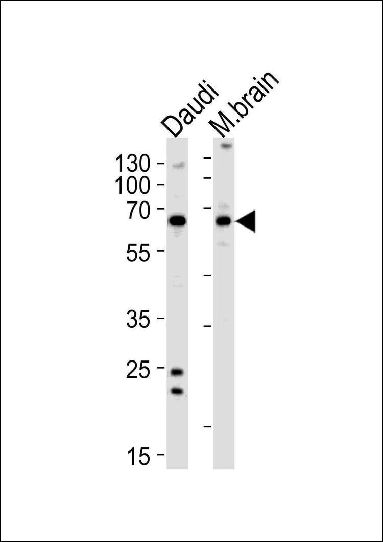 Anti-PACSIN2 (C-term) Antibody