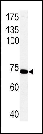 Anti-PCK1 (C-term) Antibody