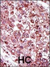 Anti-PCK1 (C-term) Antibody
