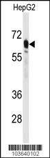 Anti-PCK2 (N-term) Antibody