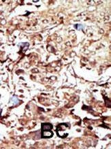 Anti-PCK2 (N-term) Antibody